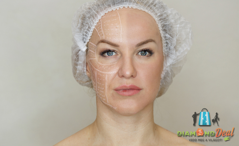 Heg nélküli Serenity MED 3D HIFU bőrfeszesítő kezelés -teljes arc, nyak, toka, dekoltázs területre!