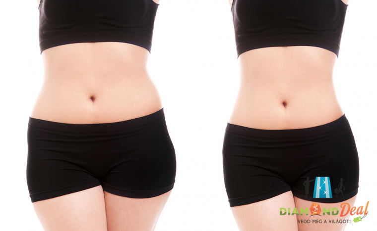 Élvezd a karcsúságot a fogyasztó Liposonic test HIFU kezelés által!