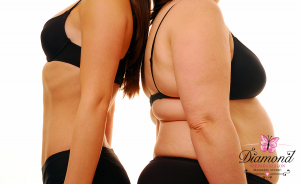 VelaShape fogyasztó kezelés és narancsbőr csökkentés + ultratone vagy vibrotréner az Oktogonnál