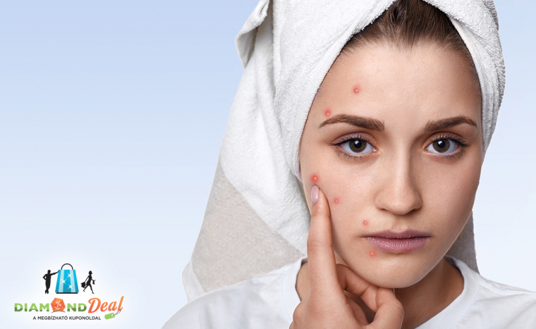 Tavaszváró bőr frissítés - gyümölcssavas hámlasztással, a makulátlan bőrért