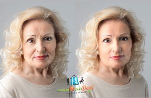 Simítsuk el a ráncokat! 6x25 perces bérlet rádiófrekvenciás arckezelés Miskolcon!