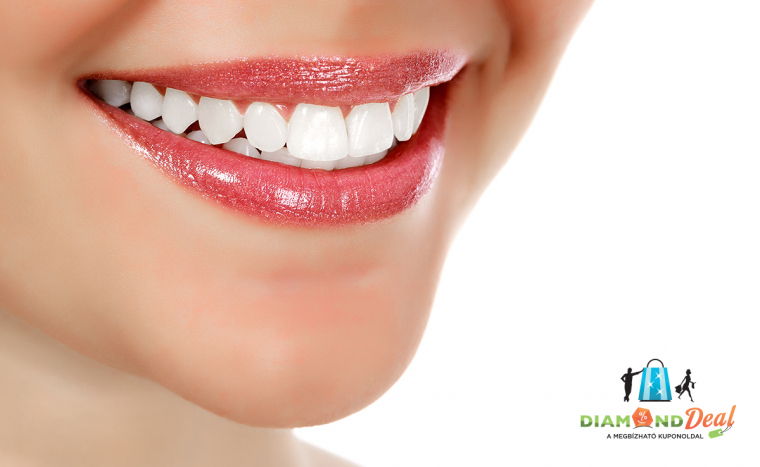 Forradalmian új eljárás! Digitális mosolytervezés a Hollán Dentál rendelőjében