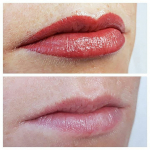 Sminktetoválás vagy kisebb méretű test tetoválás eltávolítása ajándék korrekcióval!