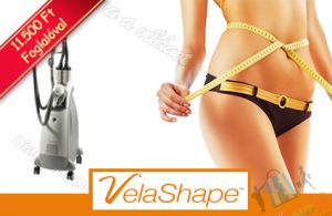 Syneron VelaShapeTM kezelés, 5 alkalommal ajándék 90 perces rózsás masszázzsal!