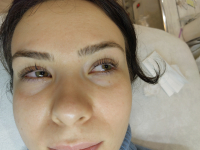 Szempilla lifting a csodás tekintetért, a VIII. kerületben