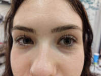 Szempilla lifting a csodás tekintetért, a VIII. kerületben