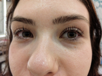 Szempilla lifting a csodás tekintetért, a VIII. kerületben