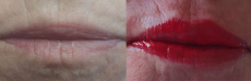 Dús és telt ajkakért - Szájkontúr tetoválás, korrekcióval a XVII. kerületben!
