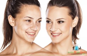 Felejtsd el a bőrhibáidat! Bőrhalványító kezelés pigmentfoltokra arc, nyak dekoltázs masszázzsal
