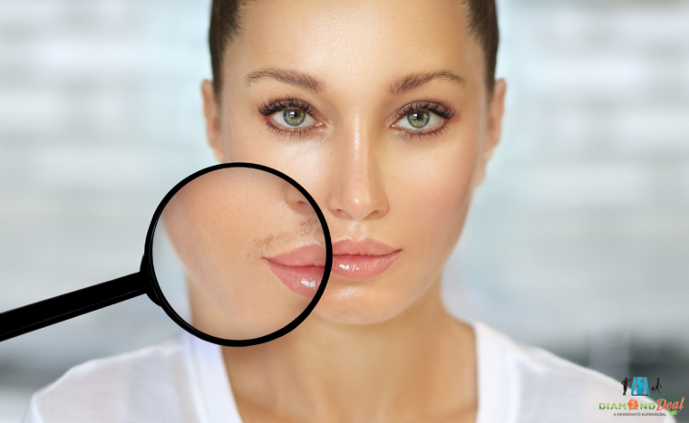 6 alkalmas dióda lézeres szőrtelenítés - felső ajak (bajusz) vagy áll területen